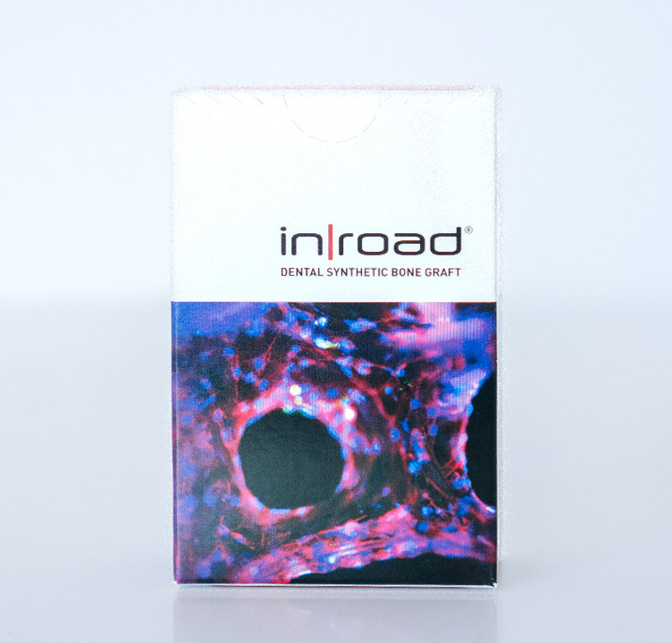 A box of inroad Dental Synthetic Bone Graft material, used in biological dentistry to support complete jawbone healing and treat cavitations.